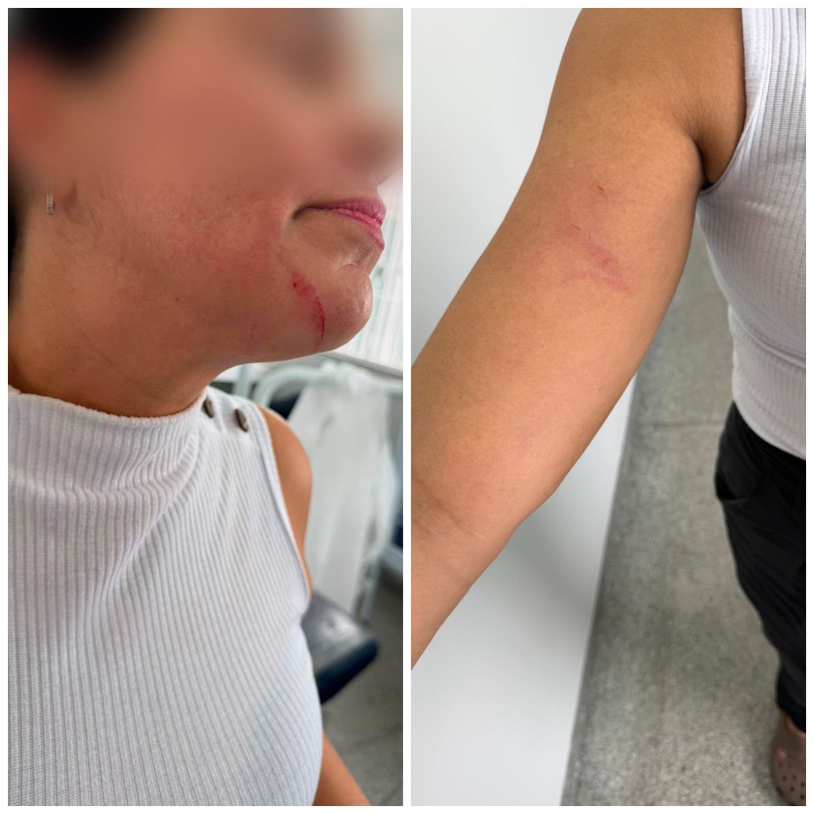 Auxiliar de saúde bucal é agredida e médica gestante é ameaçada em Rondonópolis