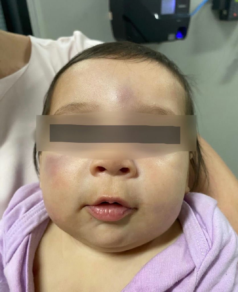 Polícia prende babá suspeita de tortura a bebê em Gaúcha do Norte