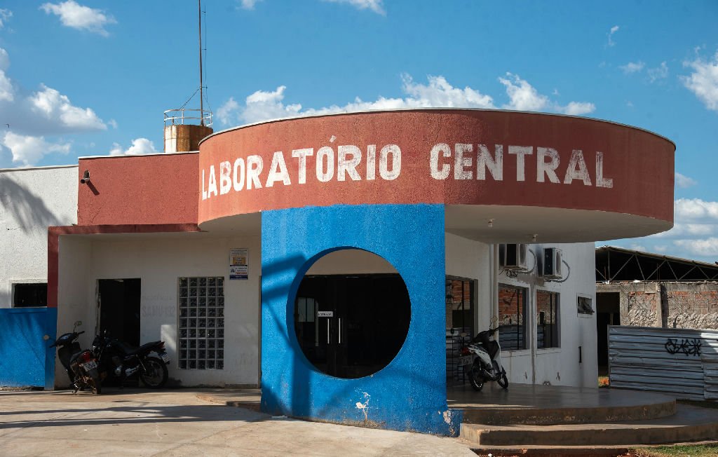 Mudança de endereço do Laboratório Central interrompe coleta de exames nos dias 24 e 25