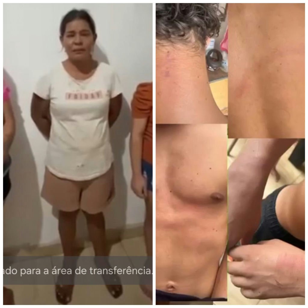 Mãe de jovem investigada por roubo denuncia tortura de filho por policiais em Rondonópolis